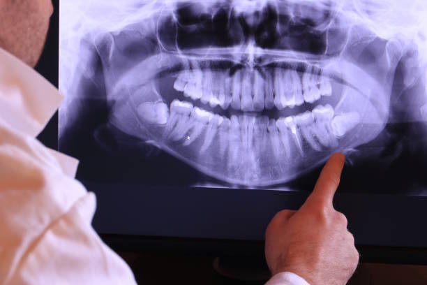 Best Emergency Treatment for Jaw Pain or Injury in Safety Harbor, FL